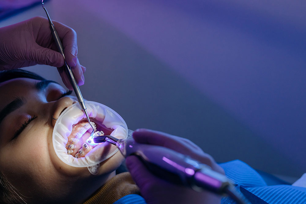 cobertura-ortodoncia-seguro-dental