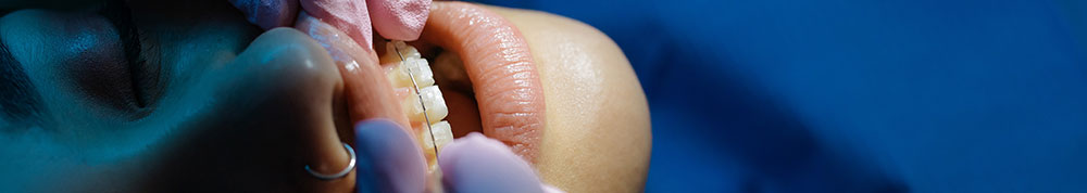 seguro-dental-que-cubra-ortodoncia